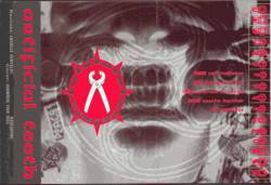 Inborn Error of Dental Doom